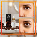 Mol20 Coffee Serum | Anti-Wrinkle & Dark Circle Remover for Youthful Eyes | 30 ML